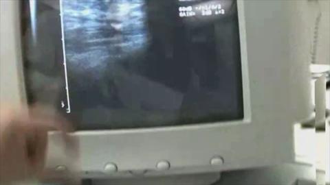 3526